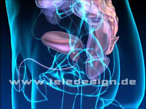 Postoperativen Behandlung von Prostata TRUS Prostata Rostov