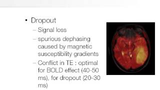 Functional MRI (fMRI)