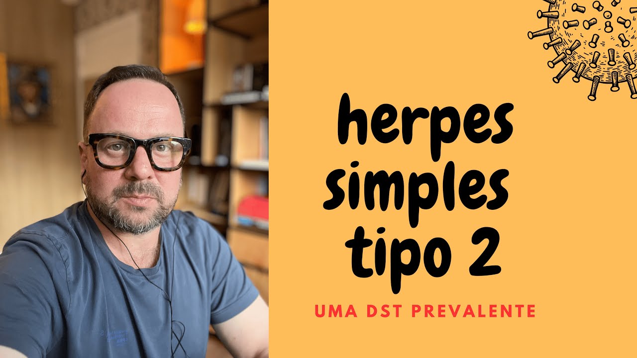 Herpes Simples tipo 2 é uma DST - Renato Cassol Médico Infectologista