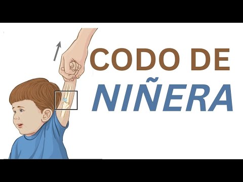 CODO DE NIÑERA MANIOBRA DE REDUCCIÓN