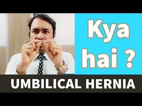 kya hai - UMBILICAL HERNIA - TREATMENT - kya operation karna jaruri hai ?