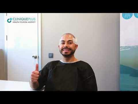 Gerardo’s Hair Transplant Process