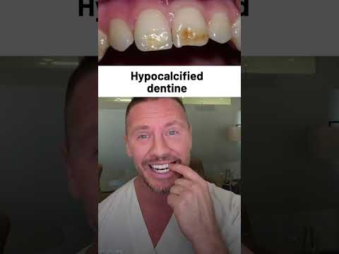 Unlock Stronger Bones and Teeth with Zinzino’s Nutritional Powerhouse