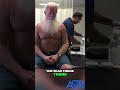 Scar Tissue Secrets Revealed See What We Found