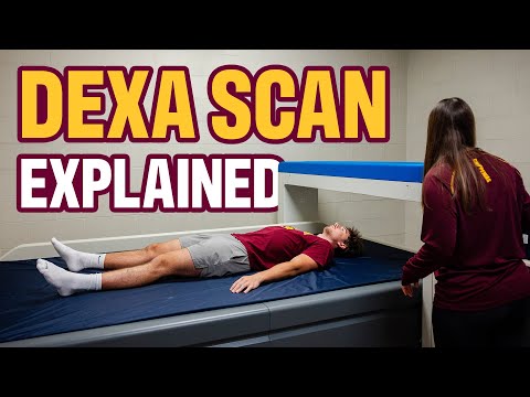 What is a DEXA Scan?