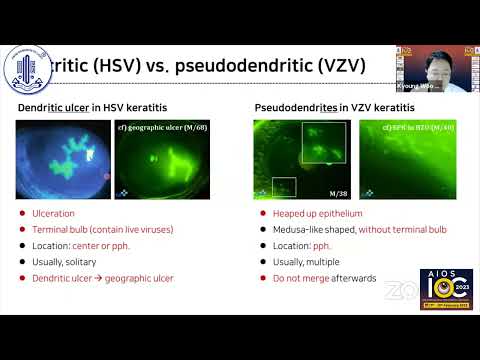 VZV vs  HSV   Similar, But Different - Prof Kyoung Woo Kim