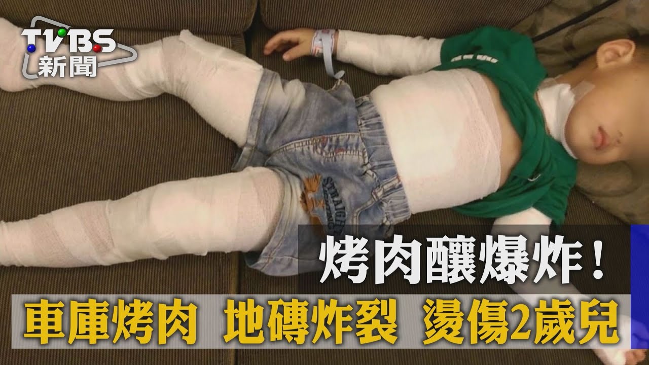 獨家／烤肉釀爆炸！車庫烤肉地磚炸裂　燙傷2歲兒