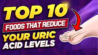 TOP 10 FOODS THAT REDUCE YOUR URIC ACID LEVELS
