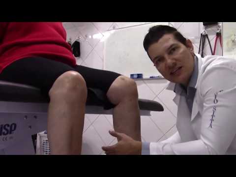 Tratamentul artrozei piciorului Preț