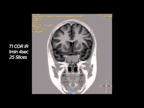 Excellent MR images within 8 minutes with Ingenia digital MRI