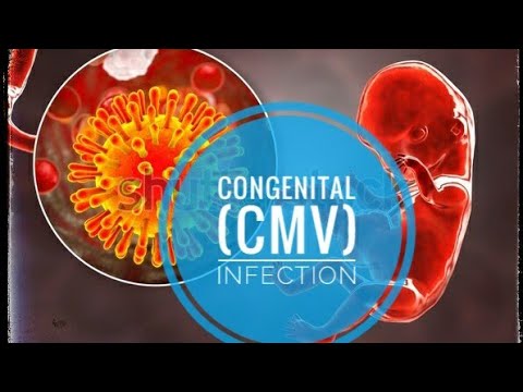 Congenital CMV infection (special edition)