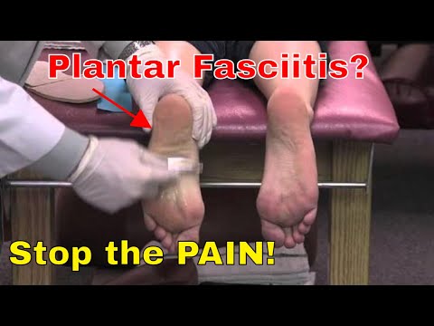 Get Rid of Plantar Fasciitis For Good!