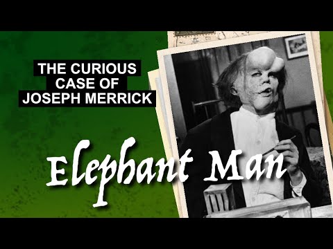 The Curious Case of Joseph Merrick