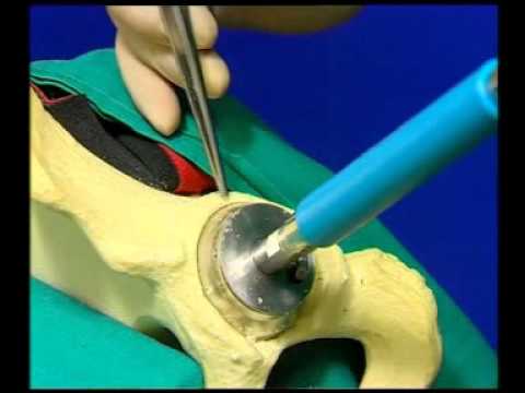 No se dobla la rodilla después de la lesión 11 ejercicios para el tratamiento. cadera