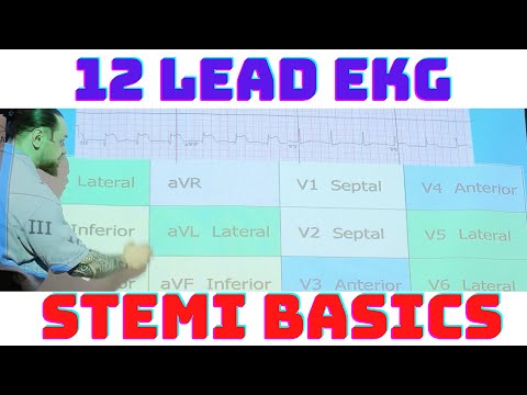 12 Lead EKG STEMI Basics: Inferior, Septal, Anterior, Lateral MI with Coronary Anatomy