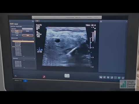 10 minute renal tumour ablation