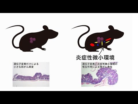 『ココカラ』Research2【がんのゆりかご 炎症性微小環境の謎を解け!】/金沢大学研究紹介動画