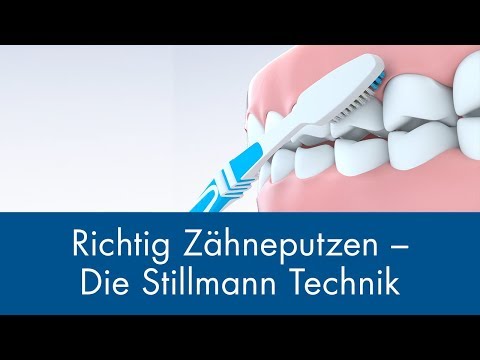 Richtig Zähneputzen - Die Stillmann Technik