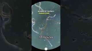 I Put a Dewormer Directly on Worms #microscope #microscopy #science