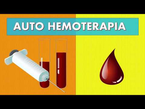 O QUE É A AUTO HEMOTERAPIA - BENEFÍCIOS