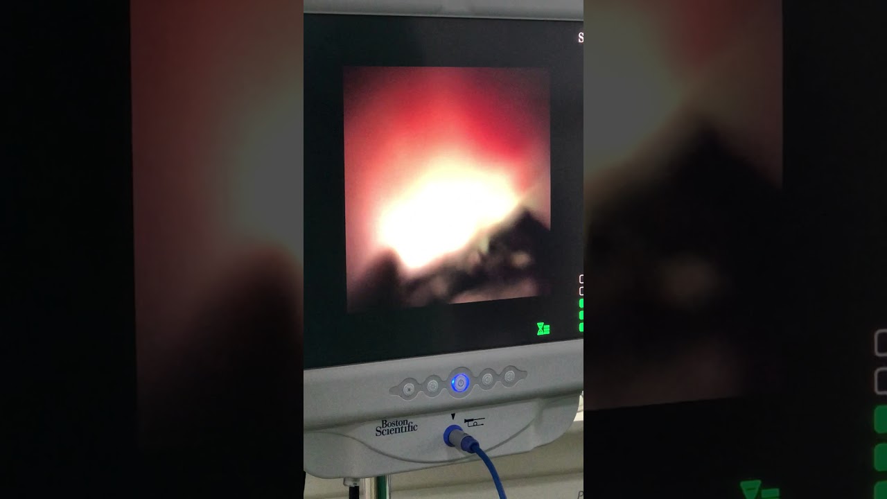 Andres Felipe Pérez Sanchez-2