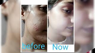 Modicare Sckin Products Result