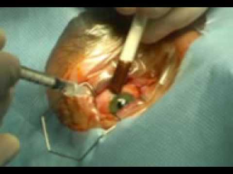Fa Tanakan di osteocondrosi Osteocondrosi come affrontare il dolore e il diritto di essere trattati