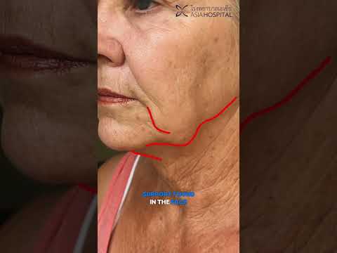 Logo of Practical Insights on the Neck Lift Procedure in Bangkok, Thailand