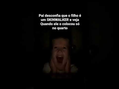 🔴 Criança Skinwalker! #shorts