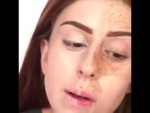 Как выводить пигментные пятна с лица Веснушки на лице что означают