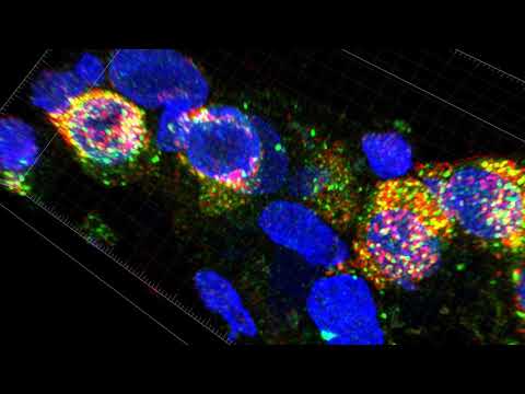 8 Year-Old Human Lung D036 8 Year-Old Human Lung D036