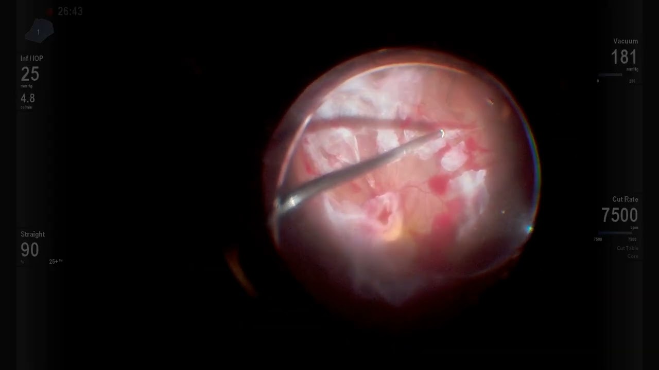 Pablo Angel Garcia Uribe-9