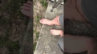 The long road back to walking after surgery #surgery #walking #farmlife #shorts