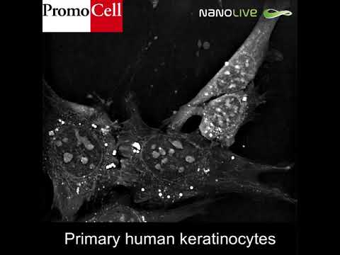 Label-free live cell imaging of primary human keratinocytes for 13 hours