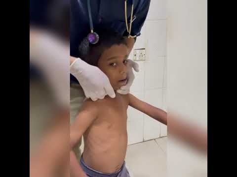 CERVICAL LYMPHNODES EXAMINATION