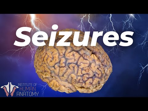 , title : 'What's Actually Happening During a Seizure'