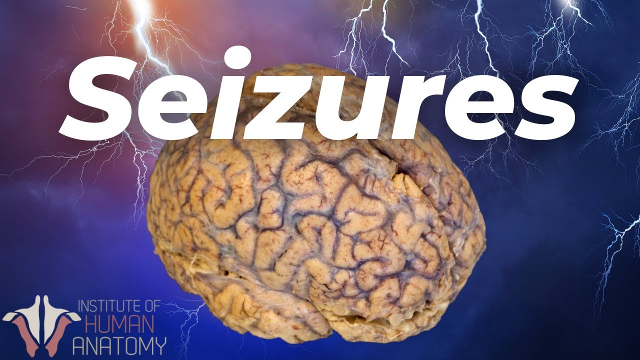 What's Actually Happening During a Seizure
