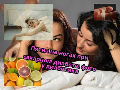 Что помогает избавится от веснушек Крем при пигментации во время беременности отзывы