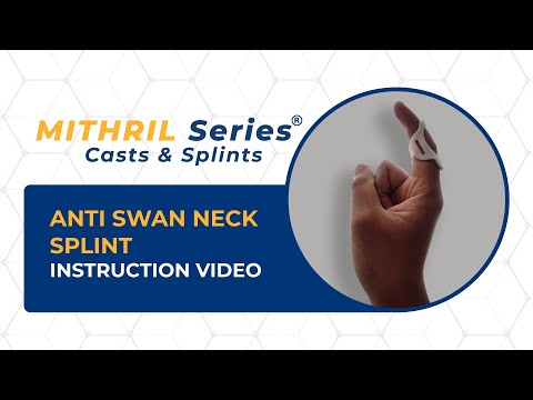 Anti Swan Neck Splint - Instructional Video