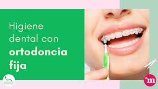Higiene dental por tipo de ortodoncia - Doctora María Isabel Salvador Martínez