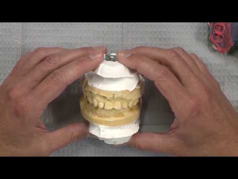 Case of the Week #87: Digital Dentistry Integration