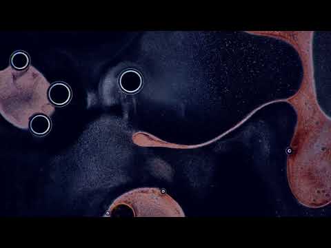 Video thumbnail for Kassel (Robot Koch Rework)