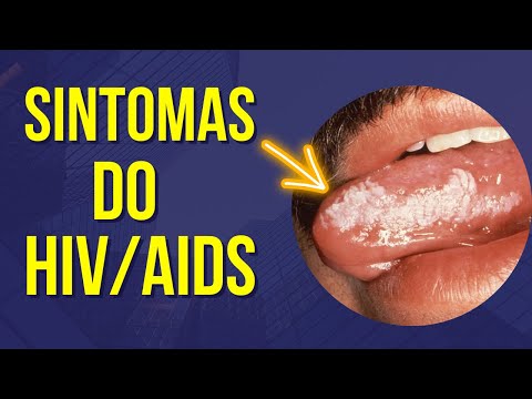 SINTOMAS DO HIV AIDS