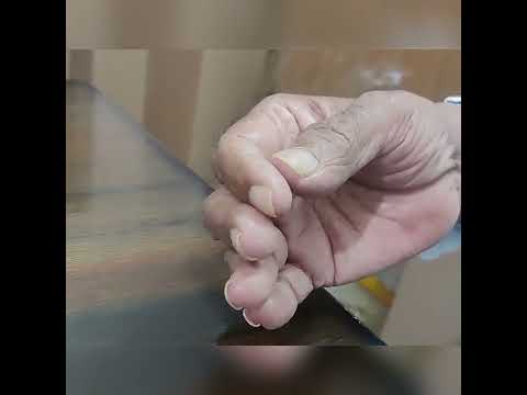 Pill rolling and resting tremors in Parkinson's disease