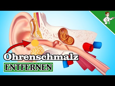 Ohrenschmalz entfernen - 5 Möglichkeiten zum Ohren reinigen