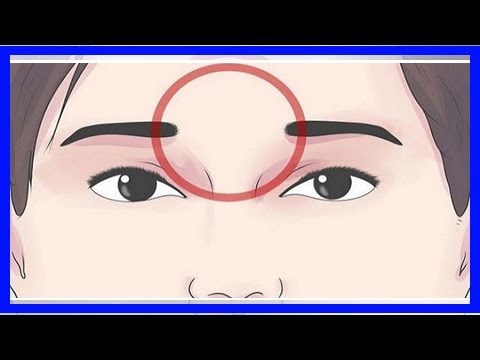 두통을 날려주는 5가지 간단한 팁