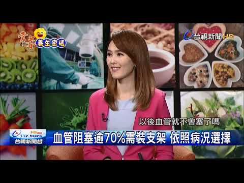 心臟支架分3類 金屬 塗藥 可吸收式模架