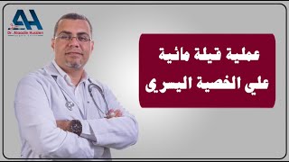 عملية حالة قيلة مائية علي الخصية اليسري