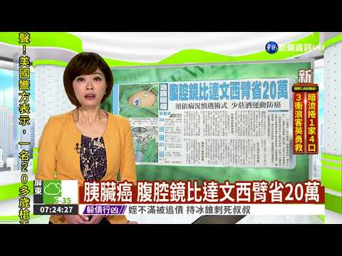 胰臟癌 腹腔鏡比達文西臂省20萬