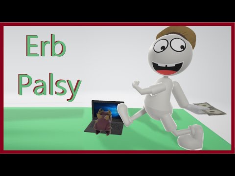 Erb Palsy (Mnemonic for the USMLE)